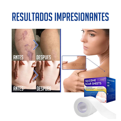 SET DE PARCHES PARA CICATRICES - REGENERATIVE PLUS